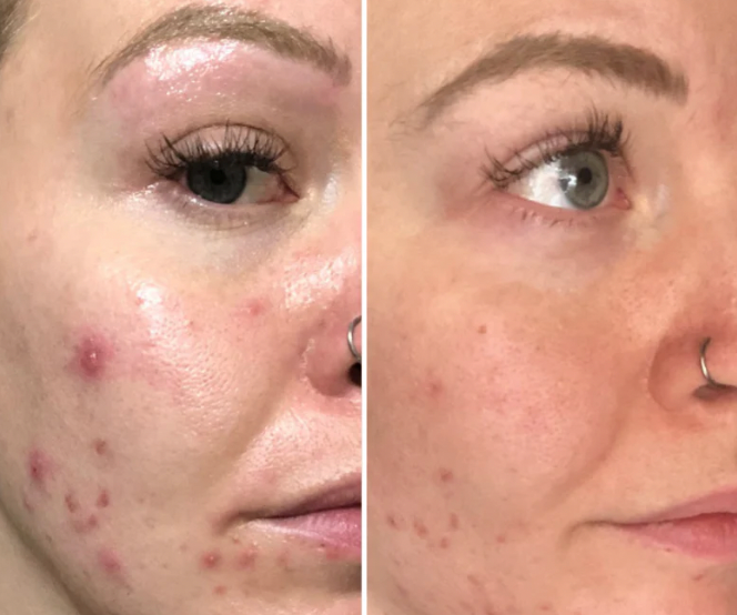 Awake Rose Hydrosol Toner image 4