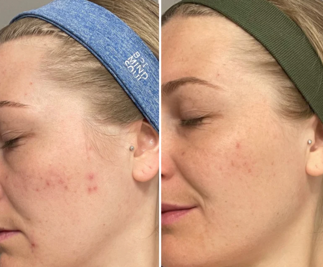 Awake Rose Hydrosol Toner image 5