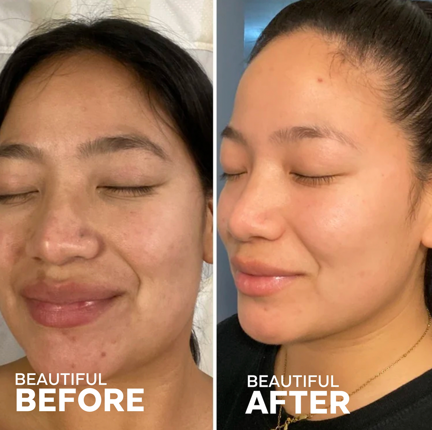 Dream Bio-Retinol + Shorea Butter Night Cream