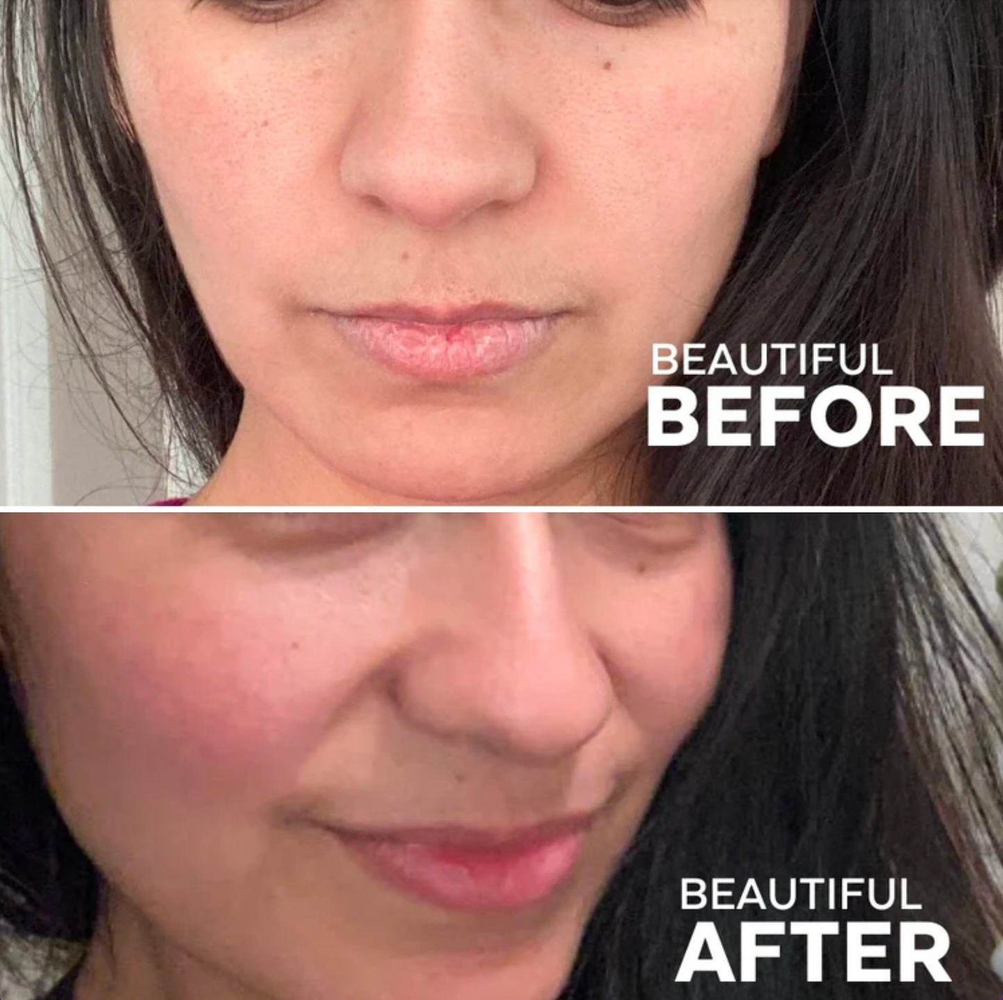 Lip Treatment Kit