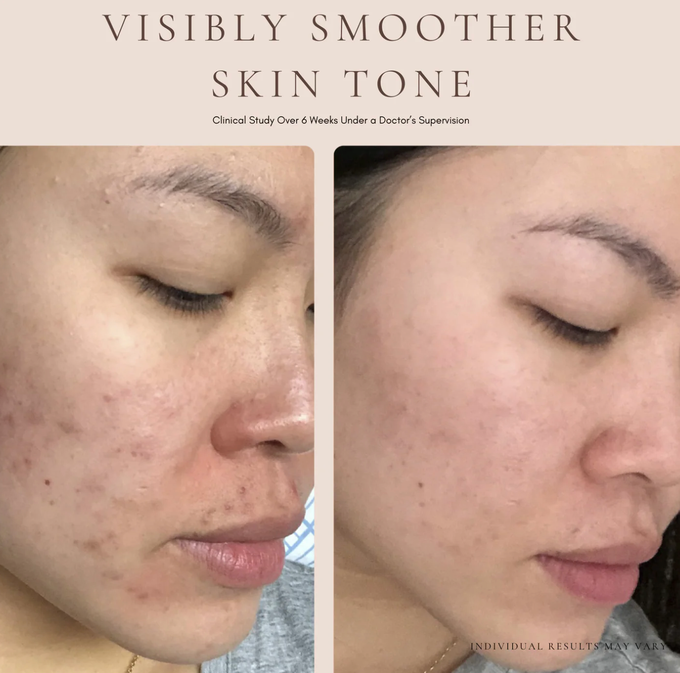 LUXURY BEAUTY SERUM - POWERFUL CALMING TREATMENT - 9ml