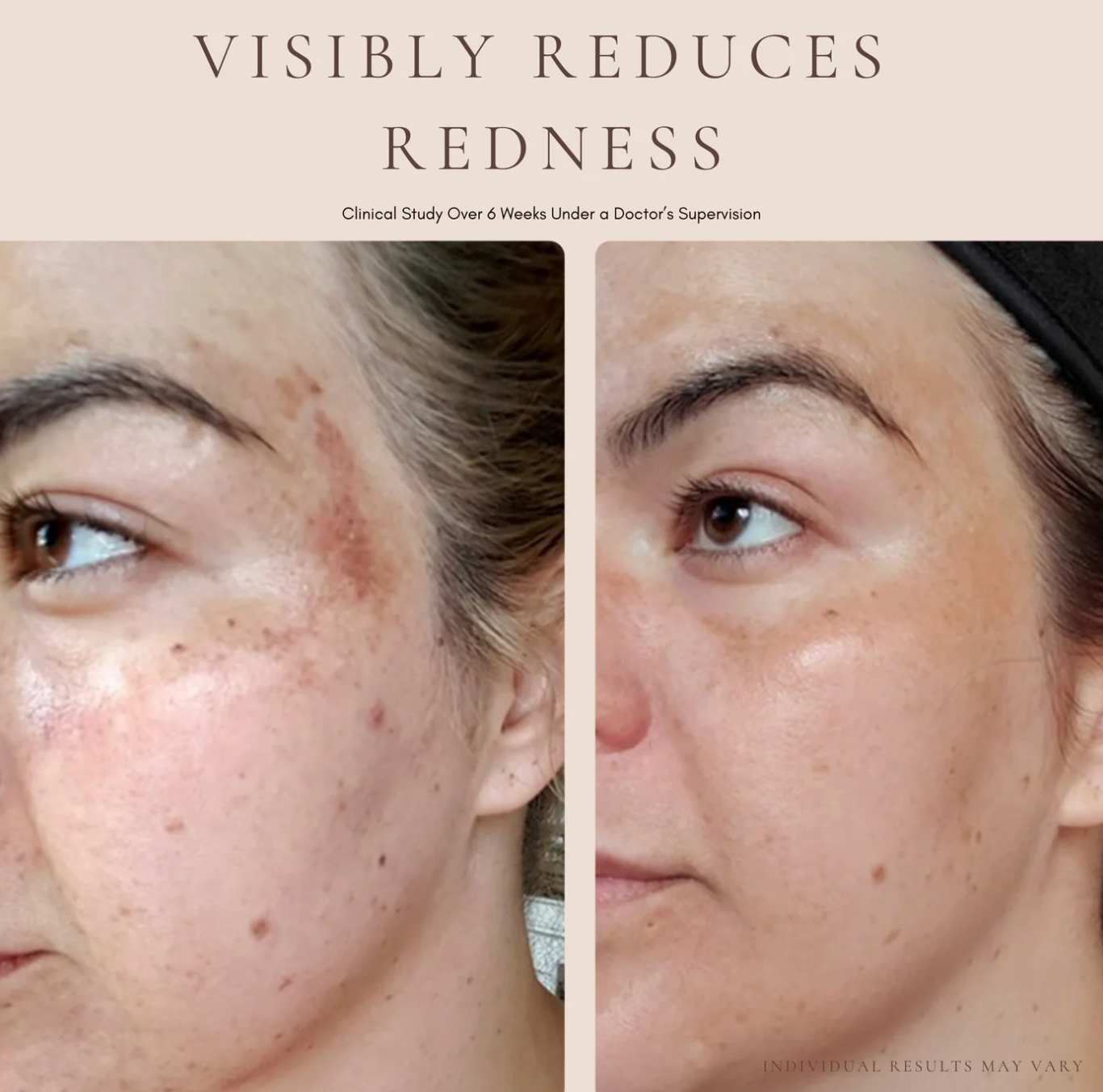 LUXURY BEAUTY SERUM - POWERFUL CALMING TREATMENT - 9ml