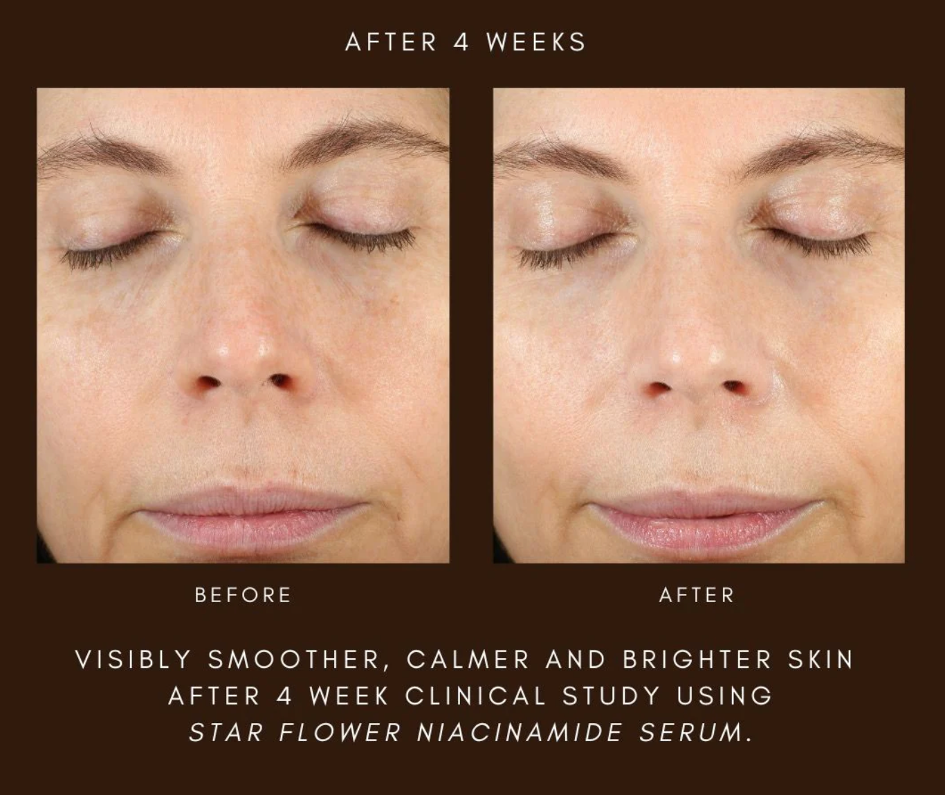 STAR FLOWER NIACINAMIDE SERUM