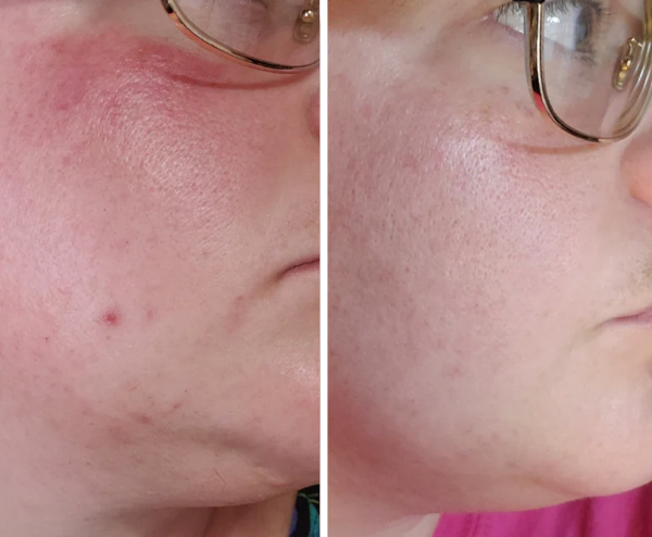 Calm Lavender Hydrosol Toner image 2