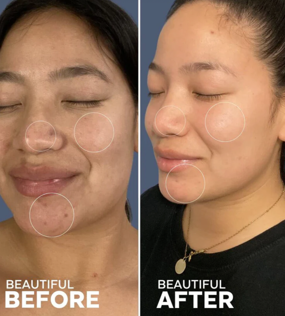 Awake Rose Hydrosol Toner image 3
