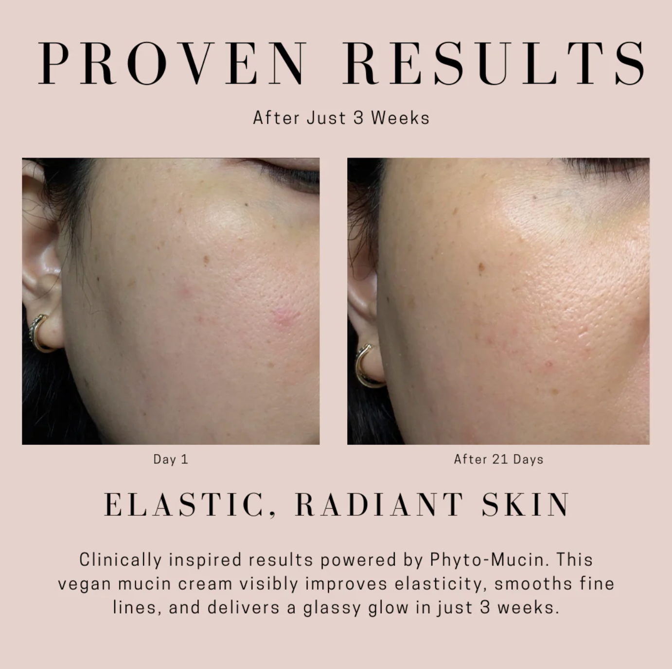 RICH RESCUE PHYTO MUCIN CREAM