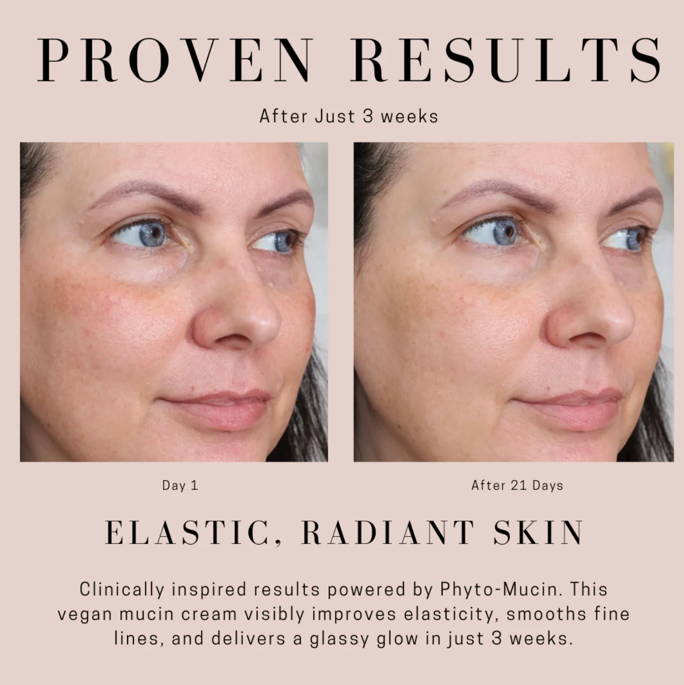 RICH RESCUE PHYTO MUCIN CREAM