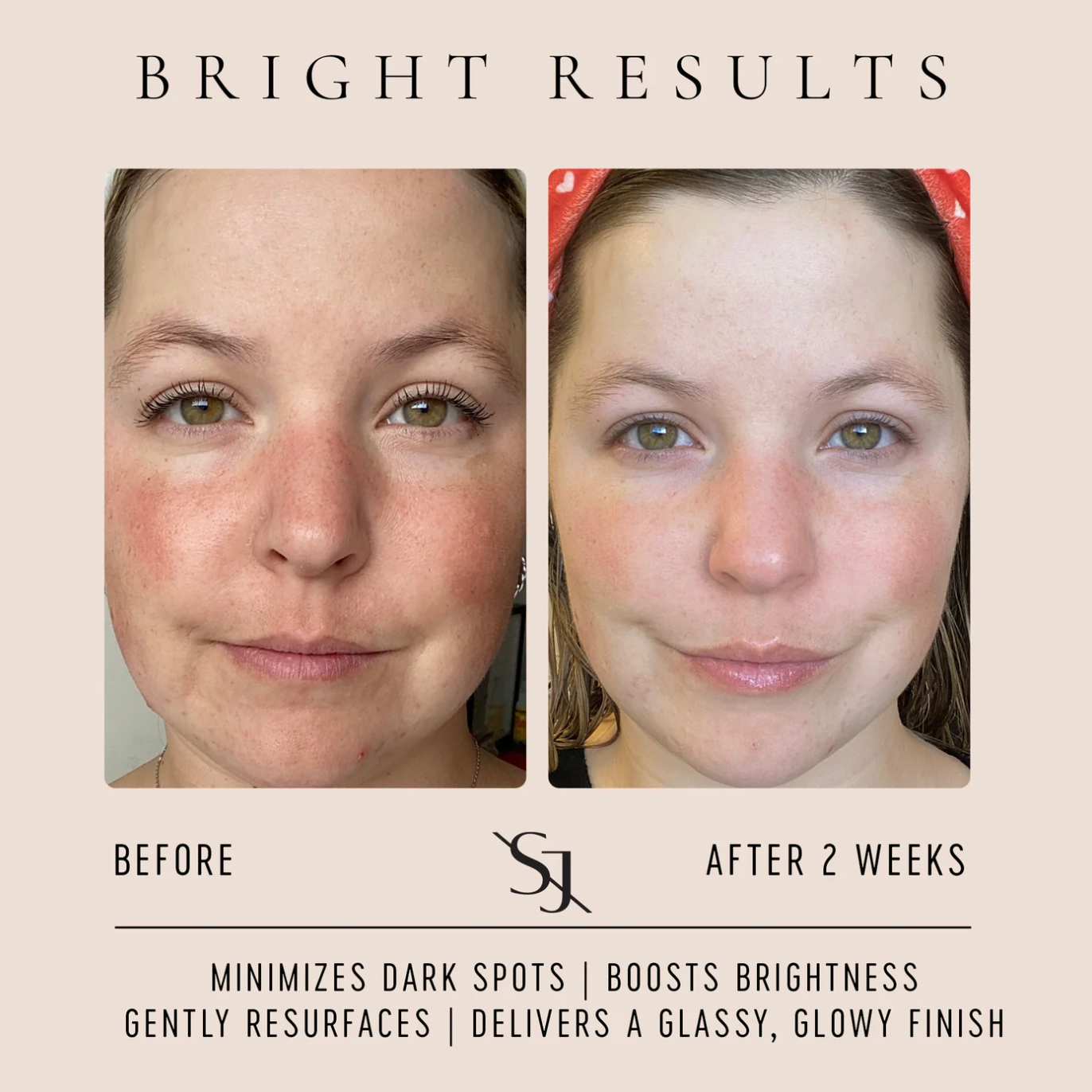 VITAMIN C GLOW DROPS - BRIGHTENING SERUM